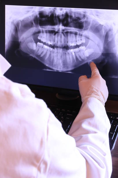 Best Emergency Tooth Extraction in Offutt Af, NE